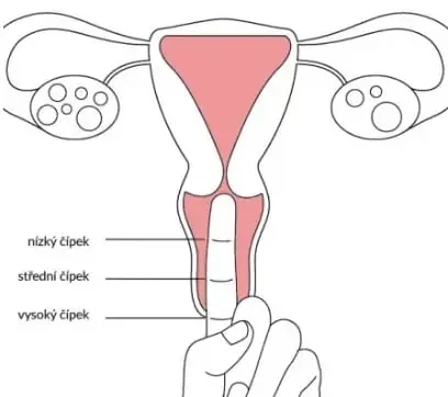 Grafik: Höhe des Gebärmutterhalses mit dem Finger prüfen – tief, mittelhoch oder hoch