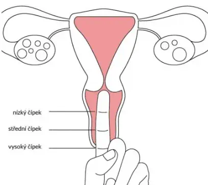 cervix_where_to_insert_a_cup